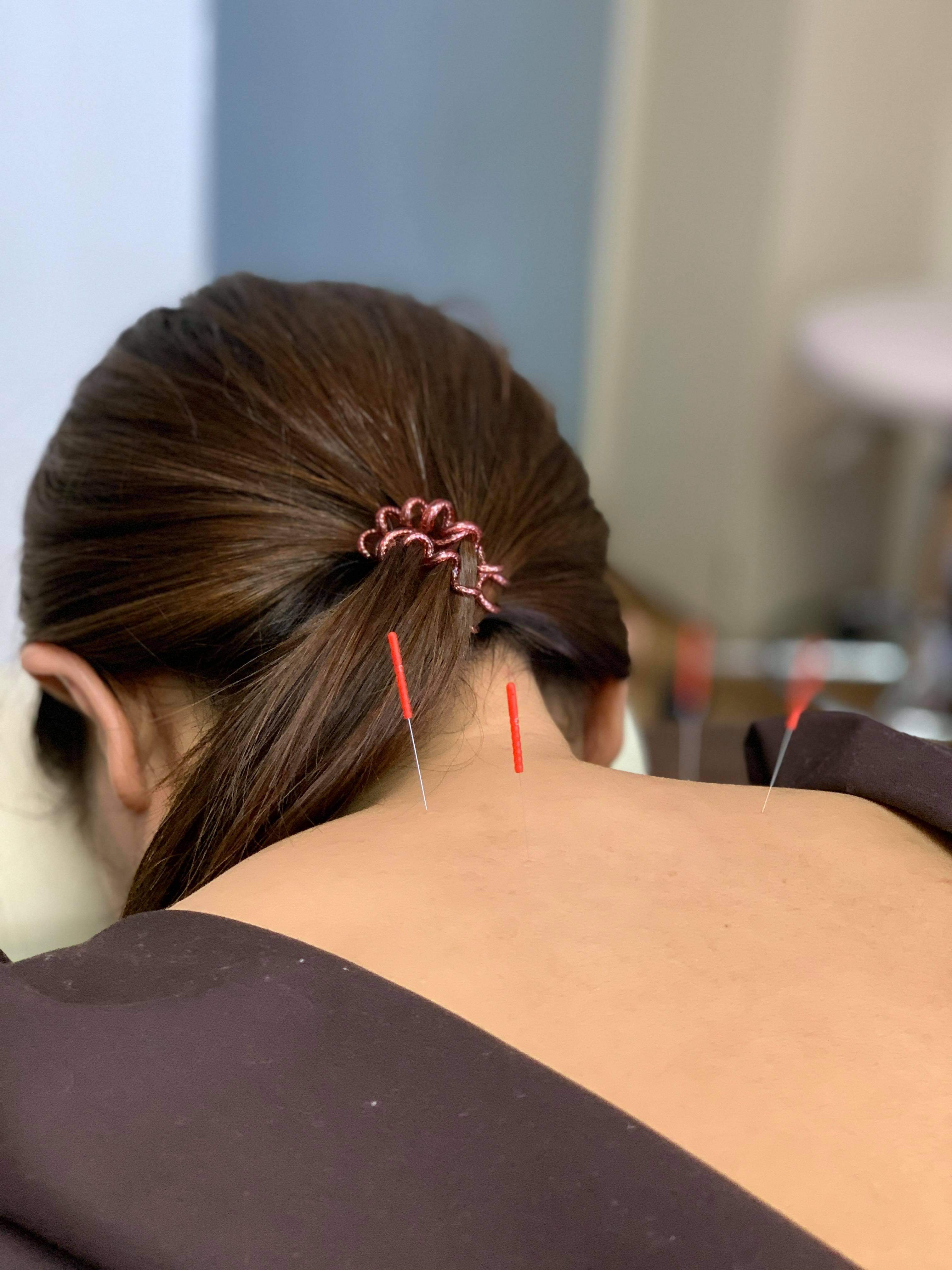 はりきゅうサロン結【更年期・妊活・自律神経ケア専門】 レディース鍼灸のメニュー画像