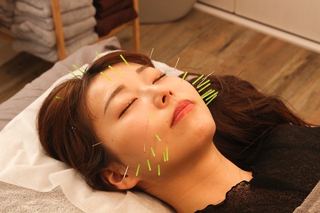 美容鍼灸サロンgen-ジェン- 人気No.1👑小顔特化美容鍼のメニュー画像