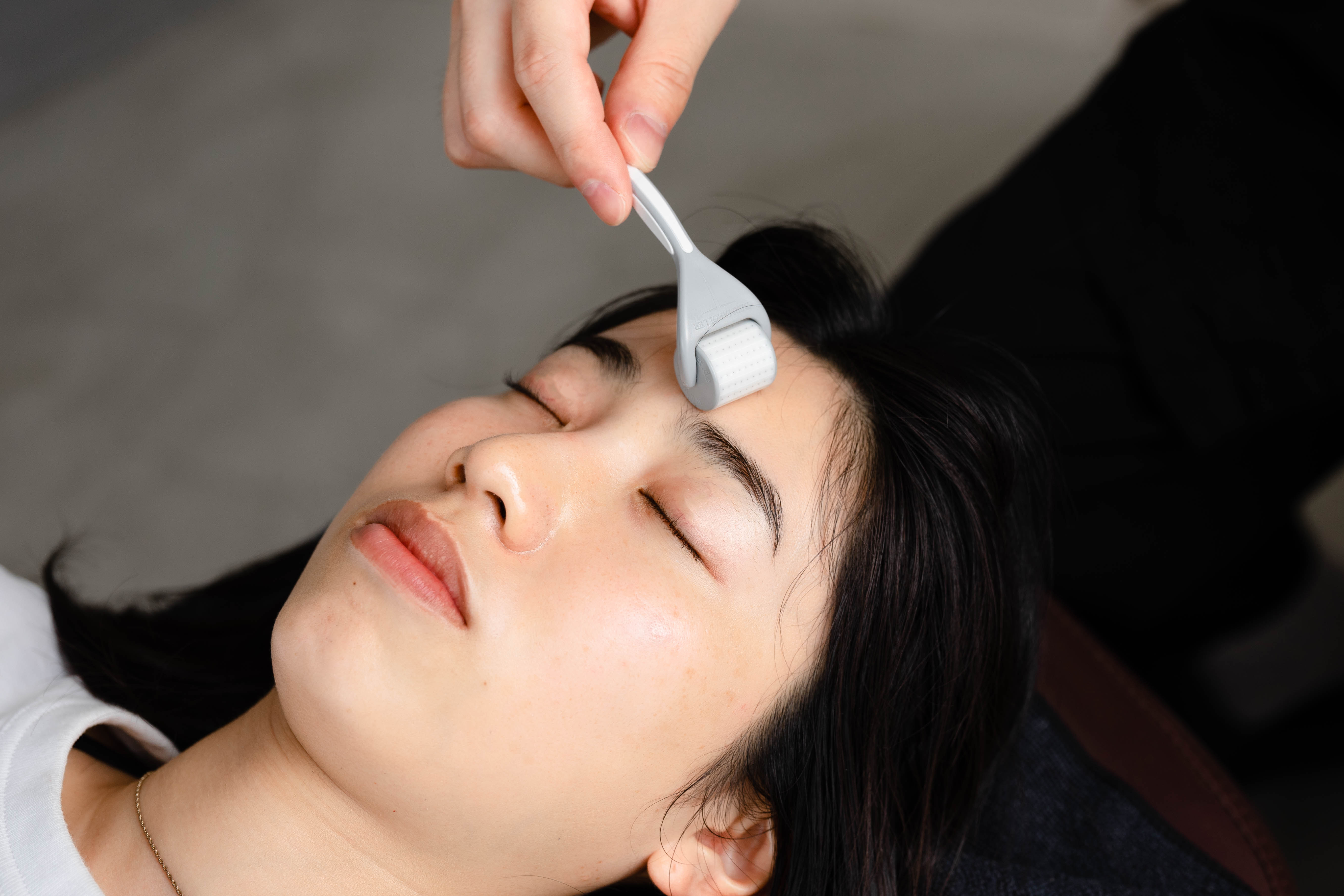 NUR HARI SPOT ダーマローラー美肌鍼のメニュー画像