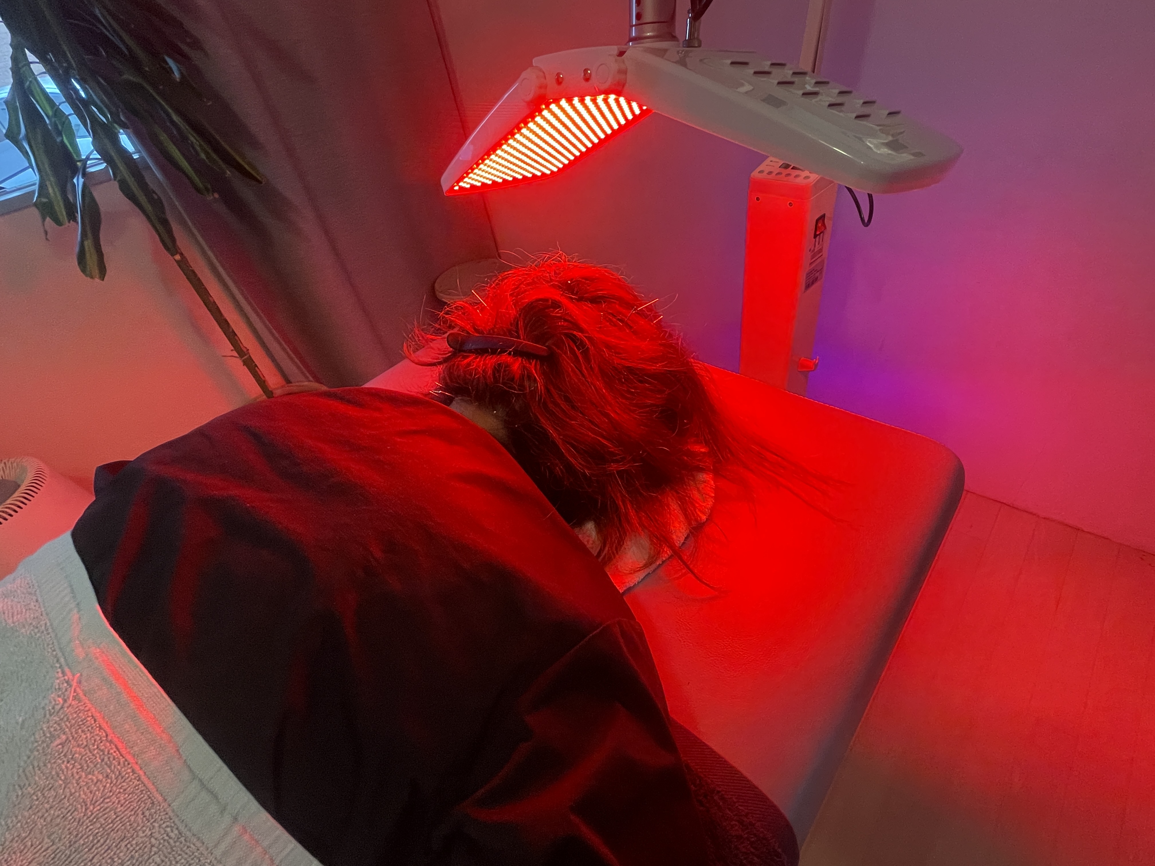 つなぐ鍼灸　トキハナ/AMATO byトキハナ 再生育毛鍼-30分-【頭皮への血行促進がカギ！】再生力を引き出しますのメニュー画像