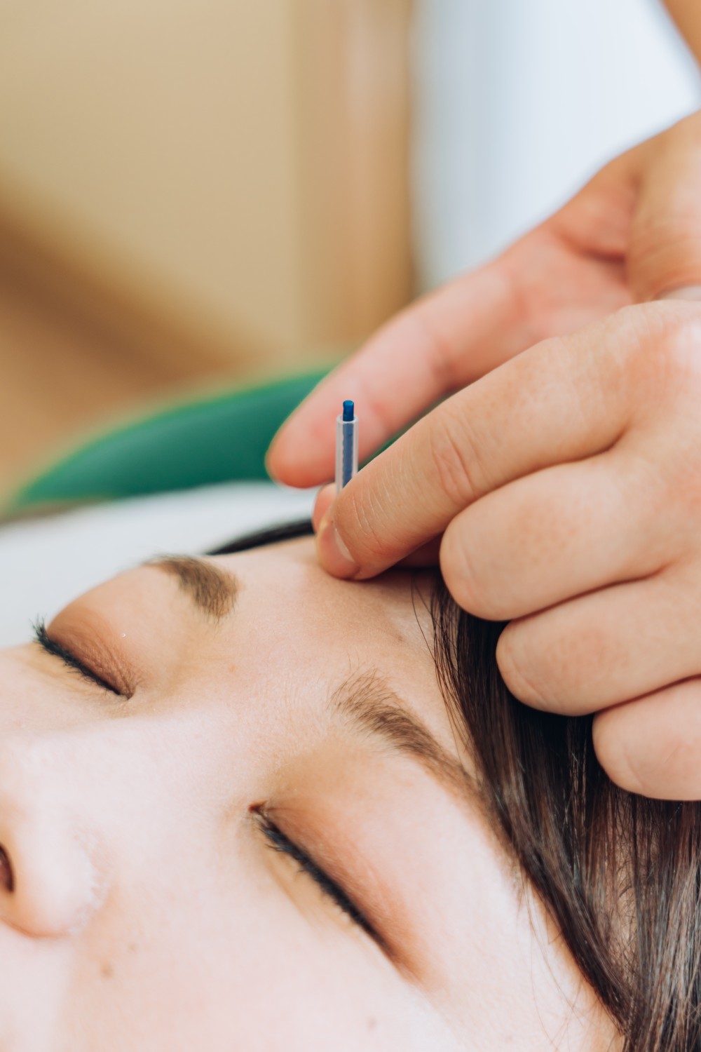 リズム鍼灸マッサージ院 鍼灸＋ICCO式美顔はり®のメニュー画像