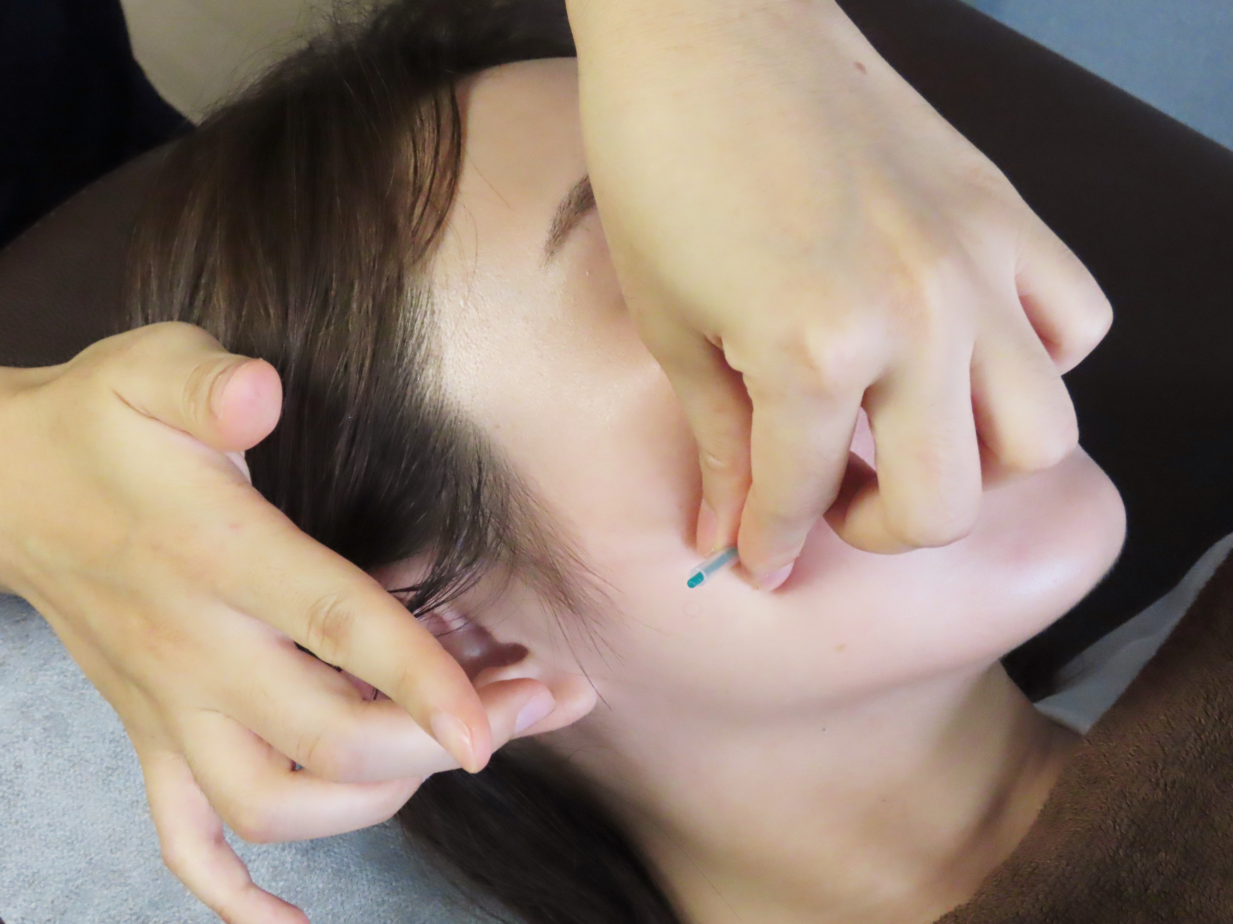 【新潟市中央区上沼】女性専用サロン　はりめぐり 美容鍼のメニュー画像