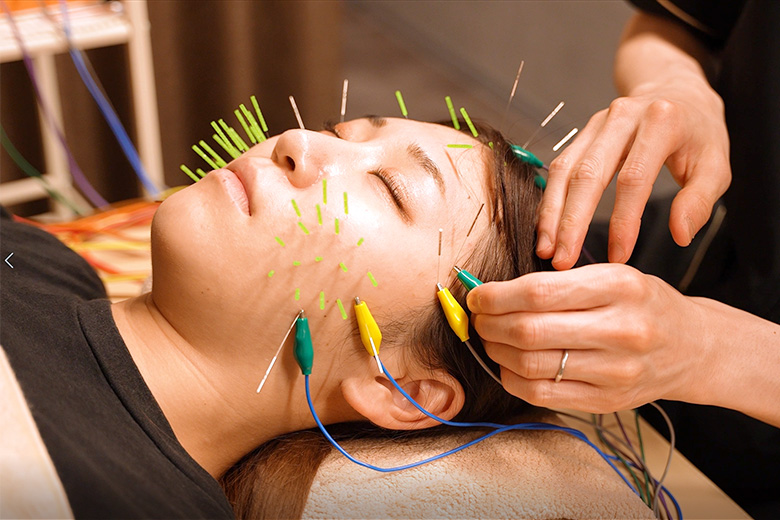 円山漢祥院　円山接骨院 美容針（１２本）のメニュー画像