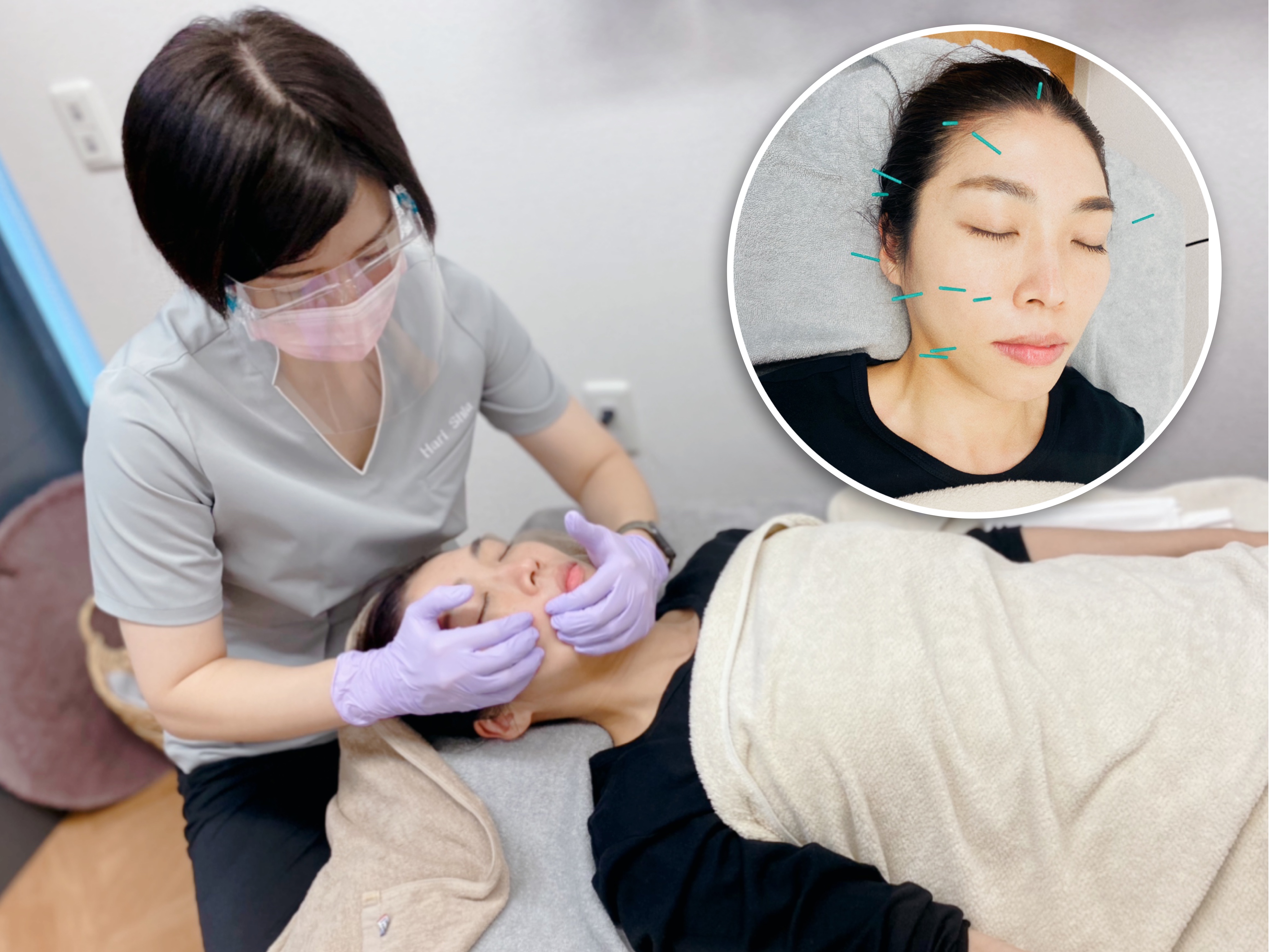 鍼灸サロン ハリシア 再来院【顔面神経麻痺】鍼施術＋リハビリ指導のメニュー画像