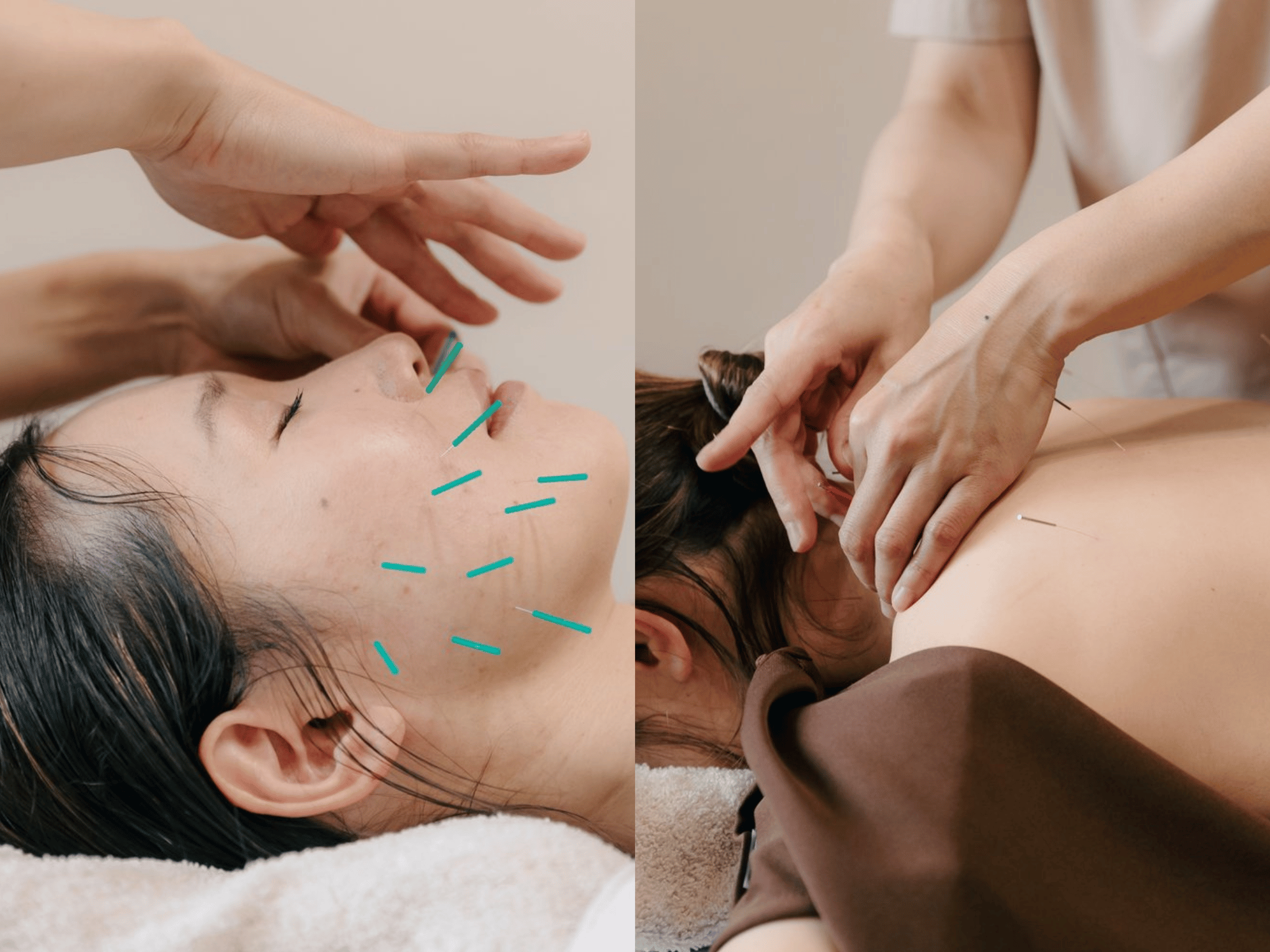 はりとお灸サロン ぬくぬく 自律神経をケアする全身はり灸+小顔美容はり90分のメニュー画像