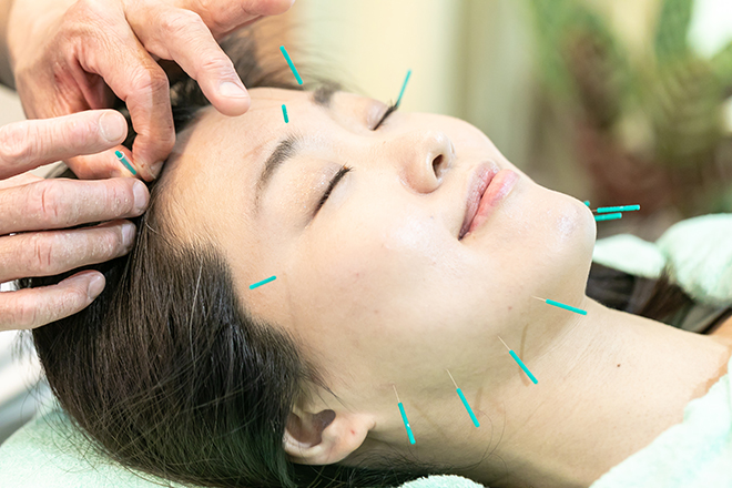 アユカ鍼灸整骨院 アユカ美療（Medicure 美顔鍼灸）初診サービスのメニュー画像