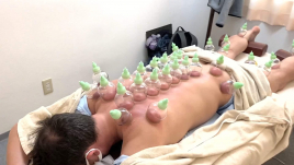 コスモ治療院 吸い玉（カッピング）鍼全身60分コースのメニュー画像