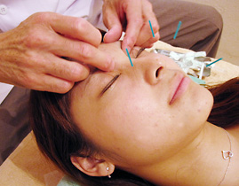 東洋堂治療院　漢方・自然薬 東洋堂 顔鍼温熱美顔療法のメニュー画像