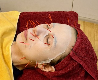 東洋堂治療院　漢方・自然薬 東洋堂 活性還元水素＋ヒト幹細胞美顔鍼（初回割引アリ）のメニュー画像