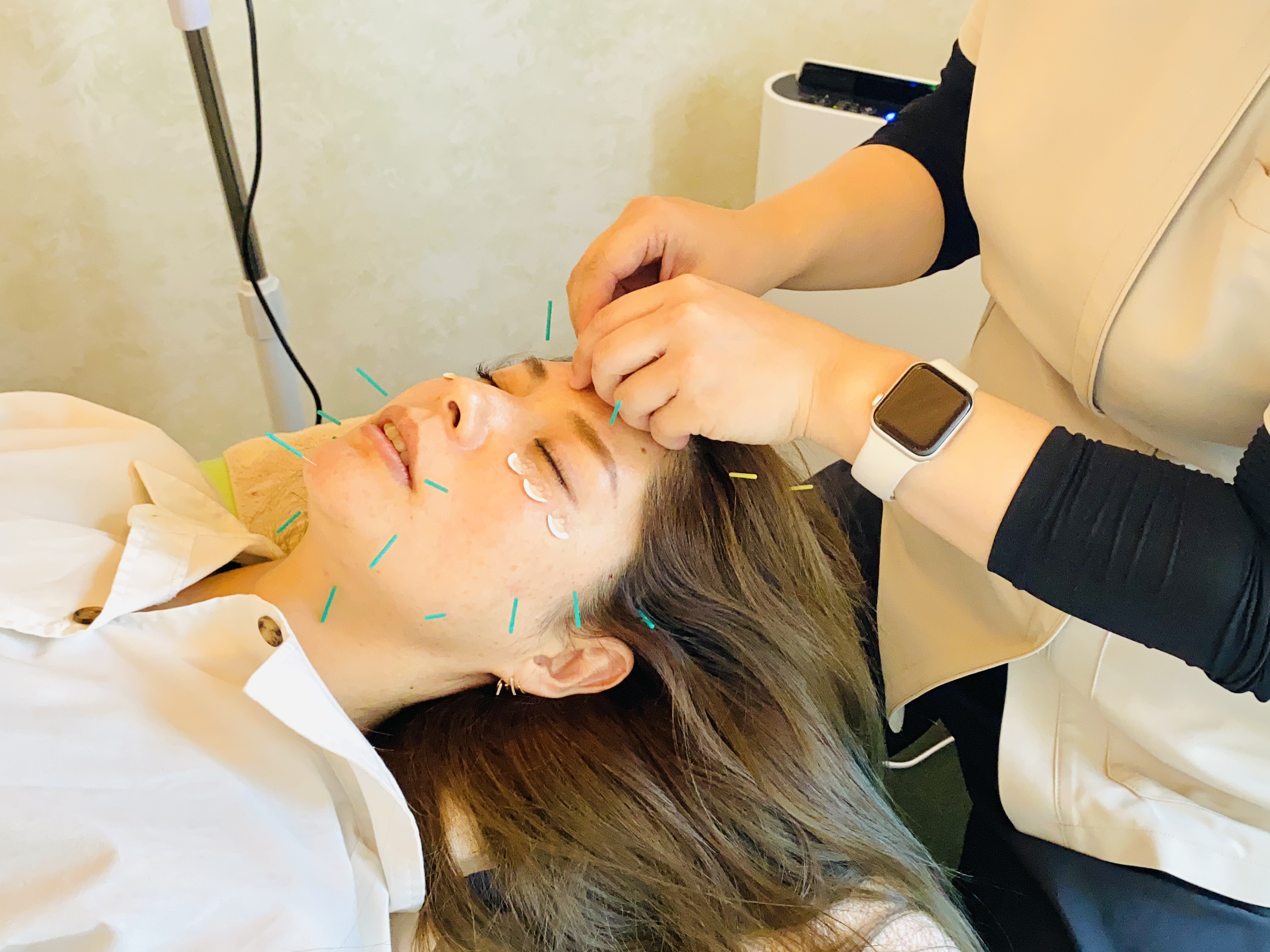 はり灸ソムリエ 美容鍼（フェイシャルケア付き）のメニュー画像