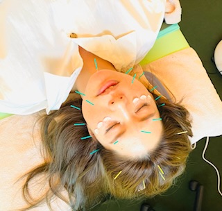 はり灸ソムリエ 美容鍼のメニュー画像