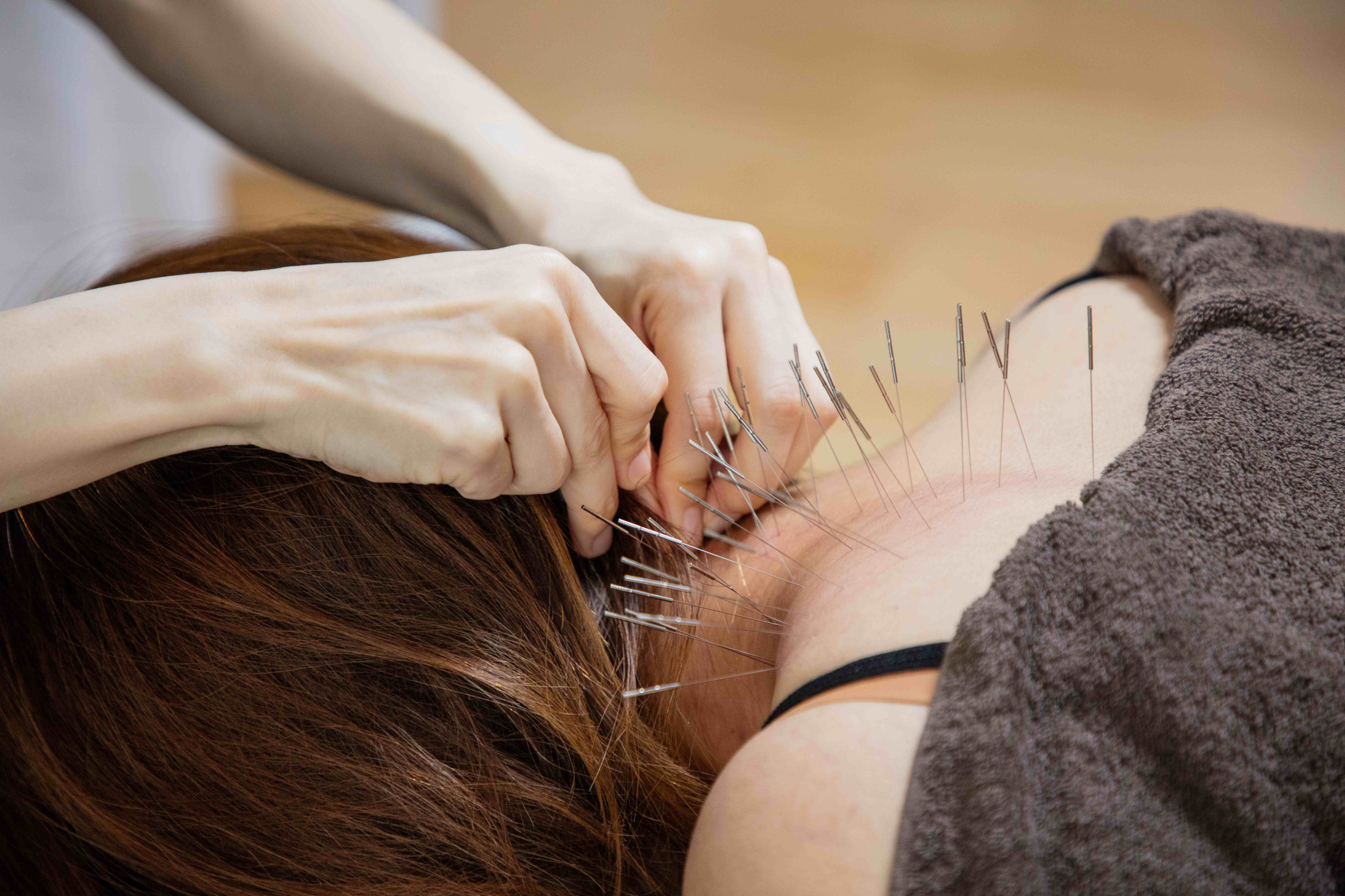 Ponoはりきゅう ルート治療 60分のメニュー画像