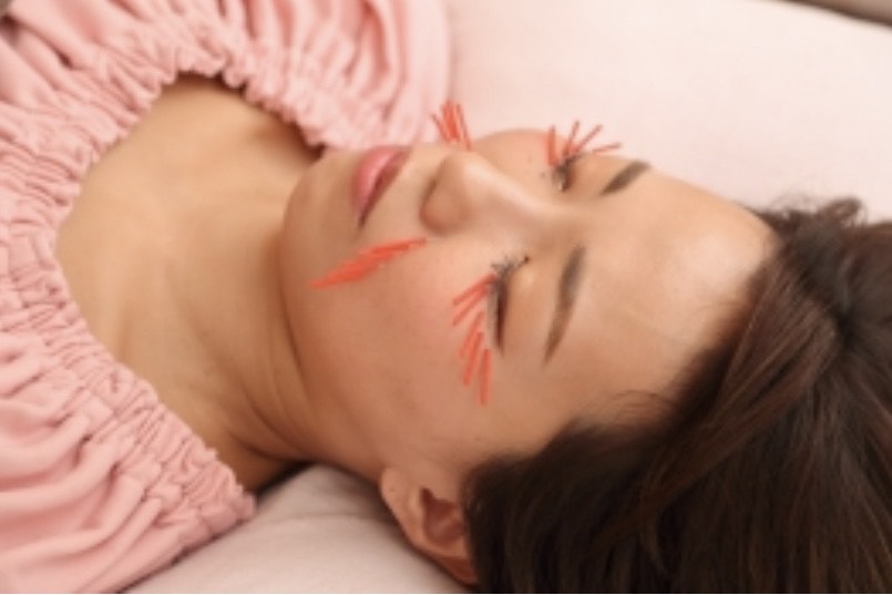 meilong 恵比寿mana院 法令線美容鍼　この金額から初回40％OFFのメニュー画像