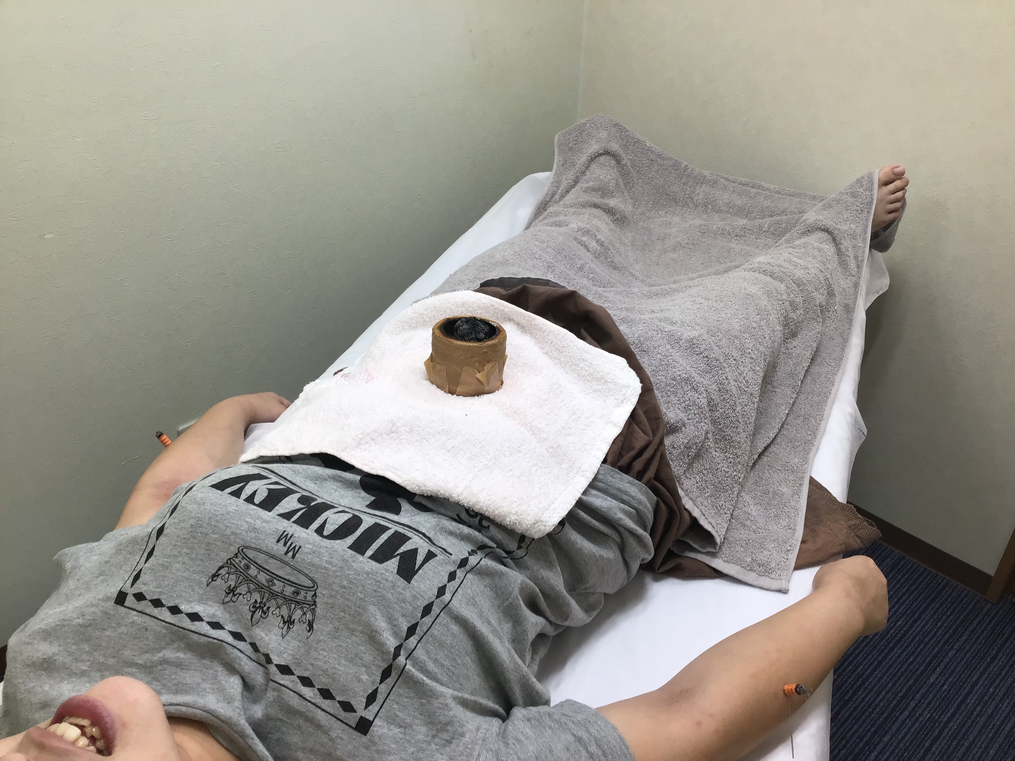 かわい鍼灸院 全身調整鍼灸施術（大学生・専門学生）のメニュー画像