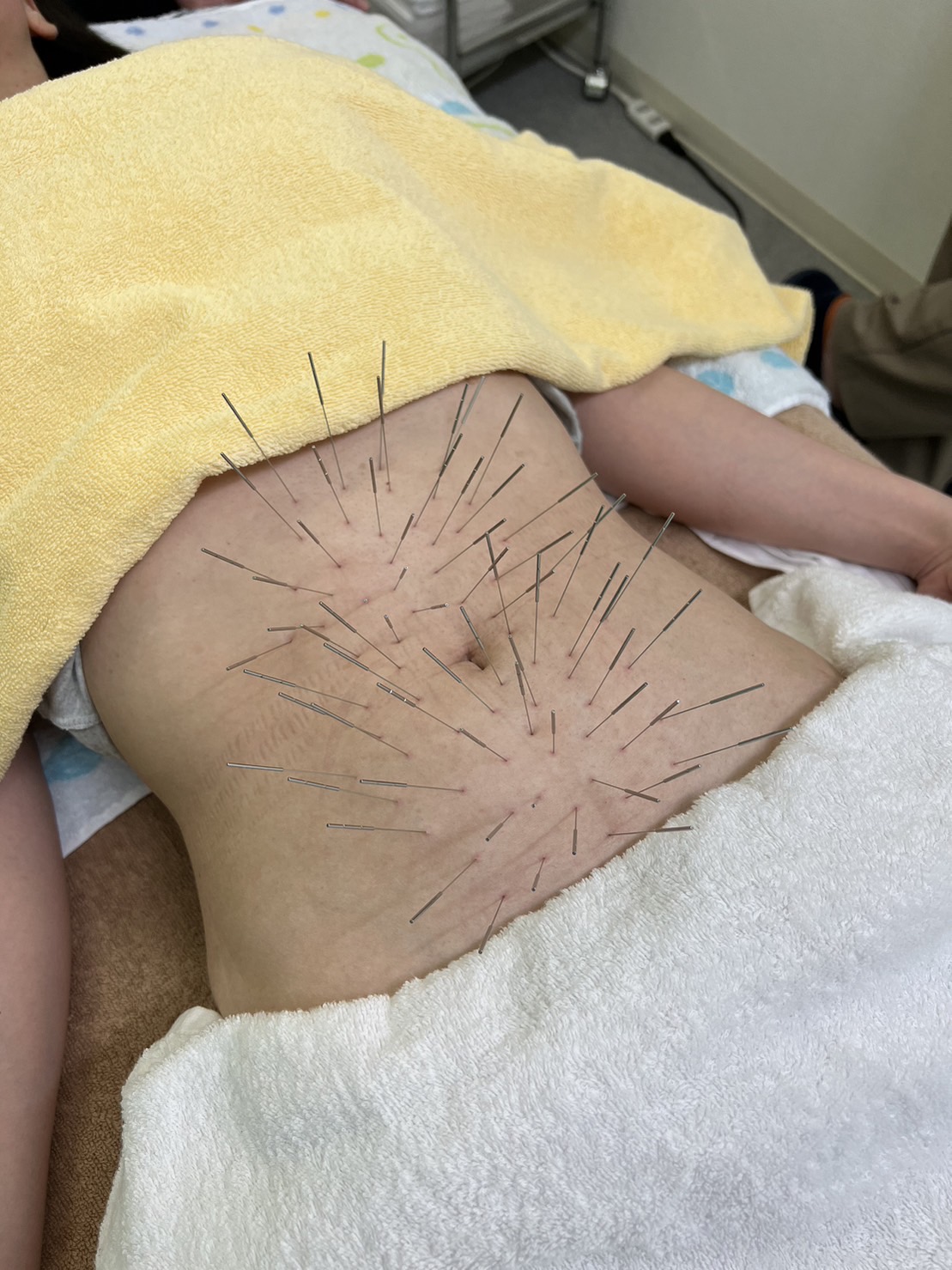 赤石はり・きゅう治療院 【初回】ルート治療60のメニュー画像