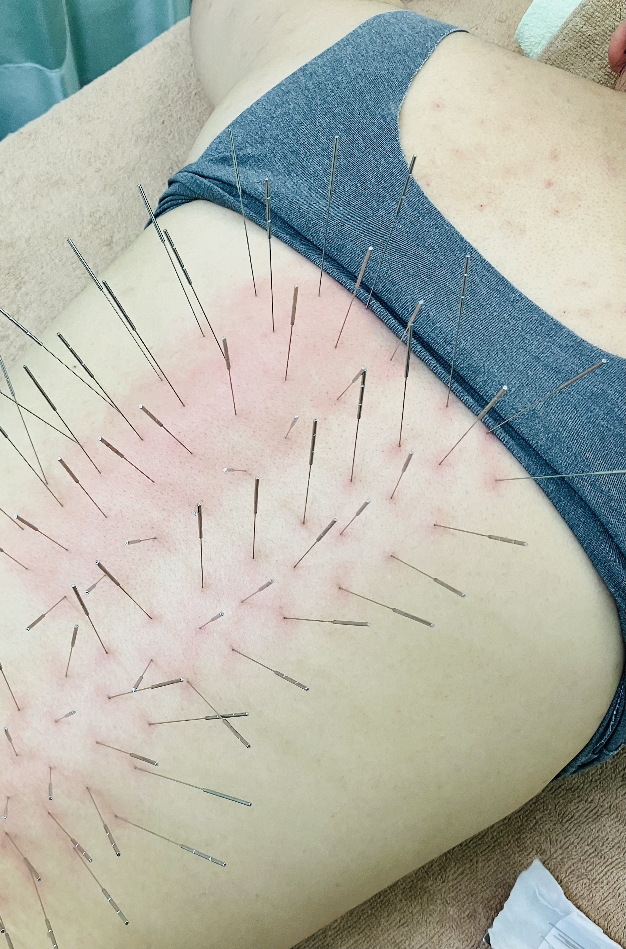 赤石はり・きゅう治療院 【2回目以降】ルート治療60のメニュー画像