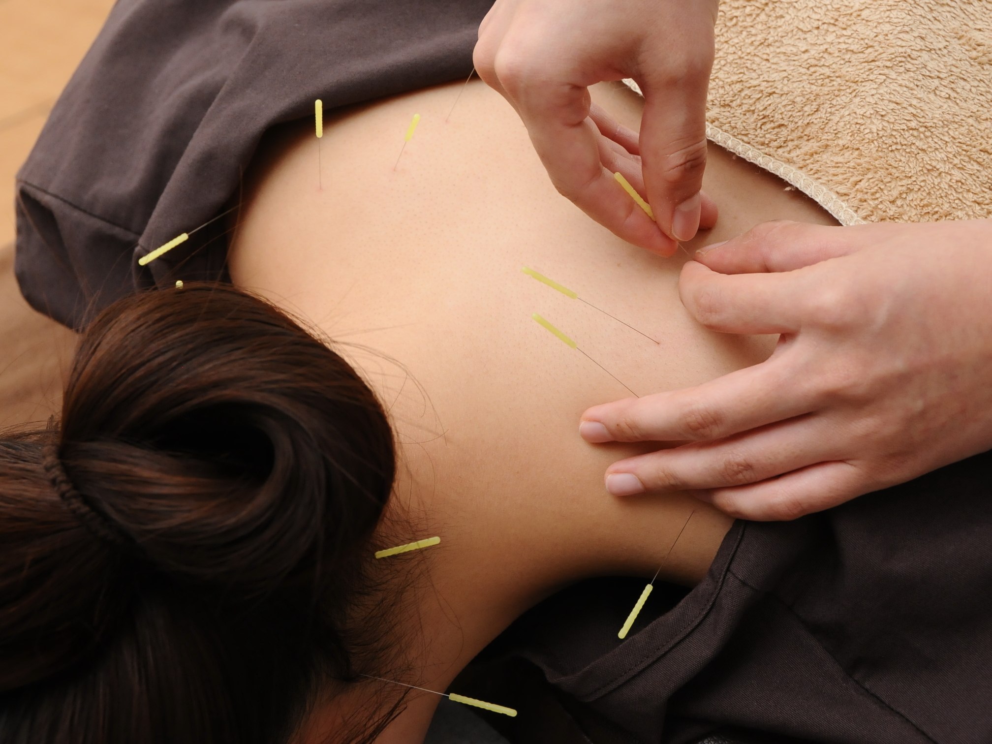 小林整骨院　立花 【首・肩こり特化】マッサージ＋鍼灸のメニュー画像