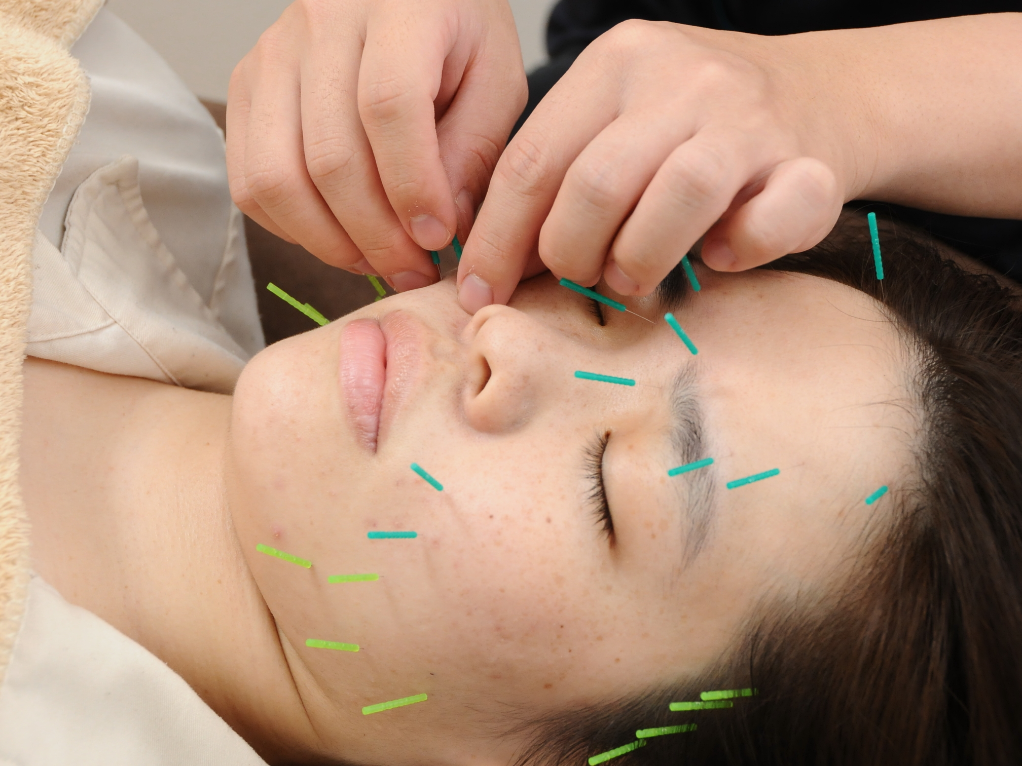 小林整骨院　立花 【肌質改善ニキビケア】のメニュー画像