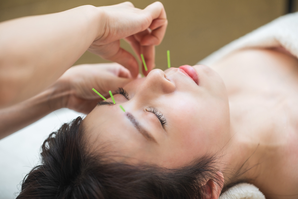 美容鍼灸サロン　ビナシス 美容鍼【30本コース】のメニュー画像