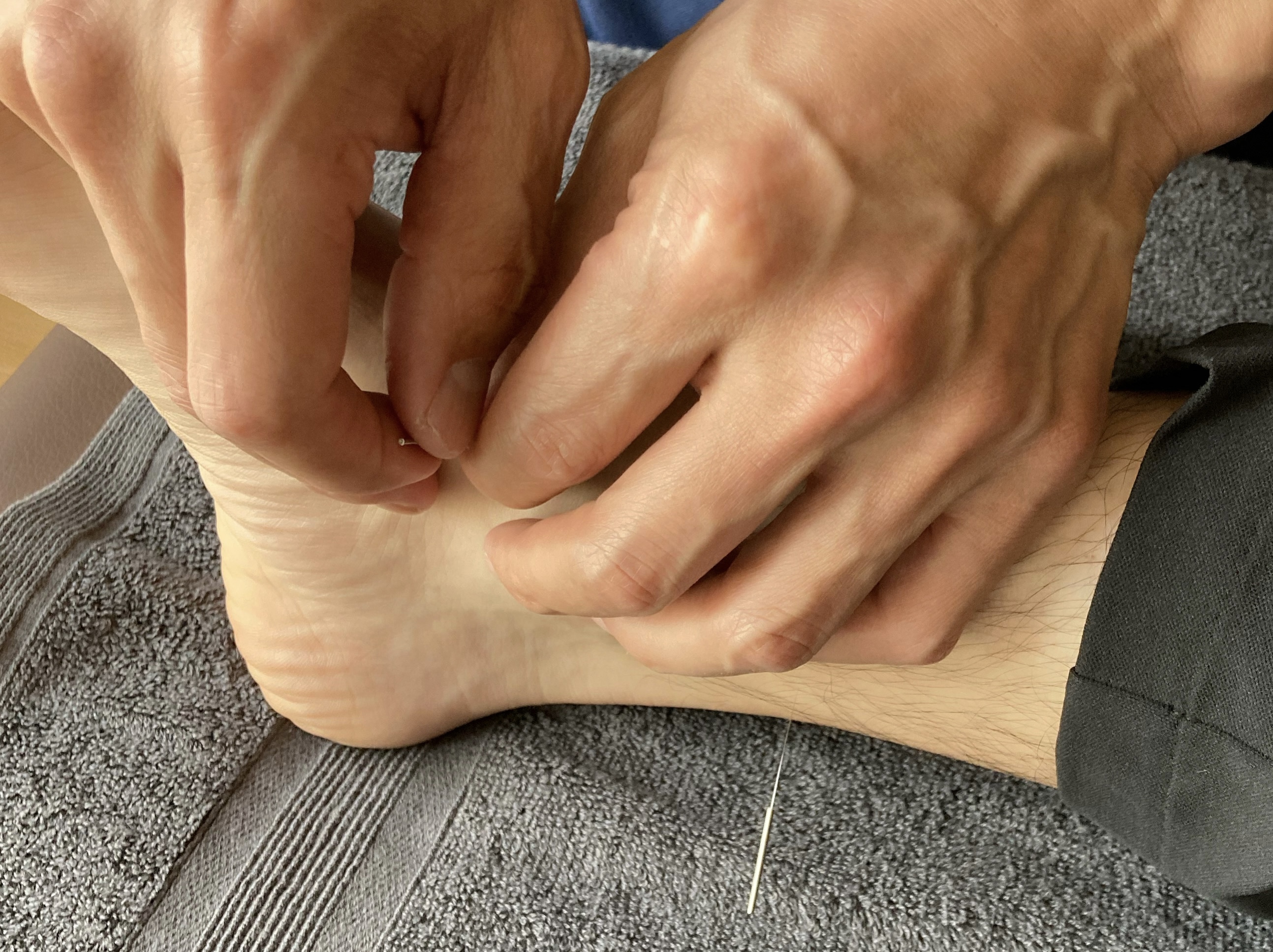 ようき鍼灸治療院 鍼灸【２回目以降】(長引く痛み・不調に。血流促進・自律神経)のメニュー画像