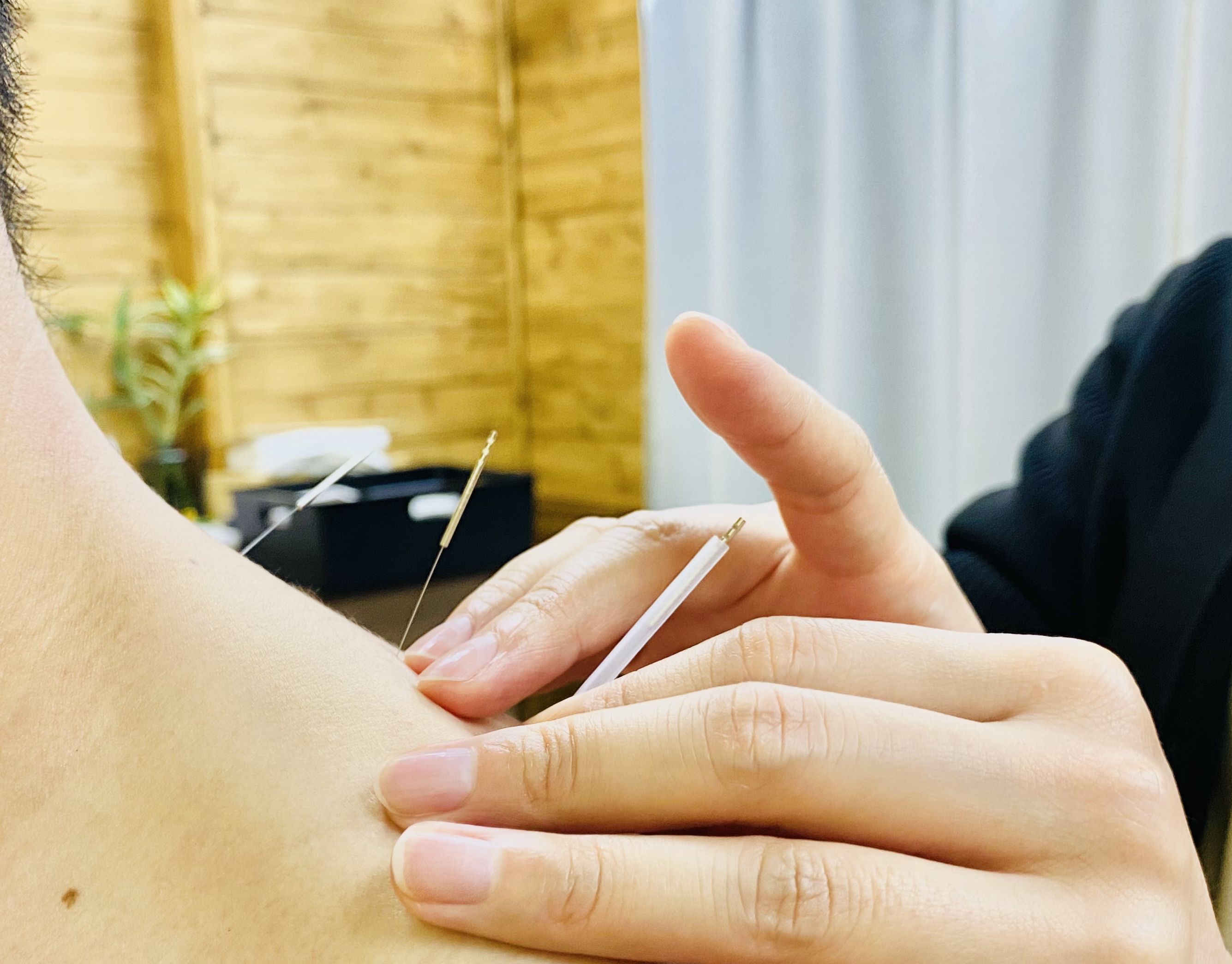 鍼・灸かほり 部分鍼施術のメニュー画像