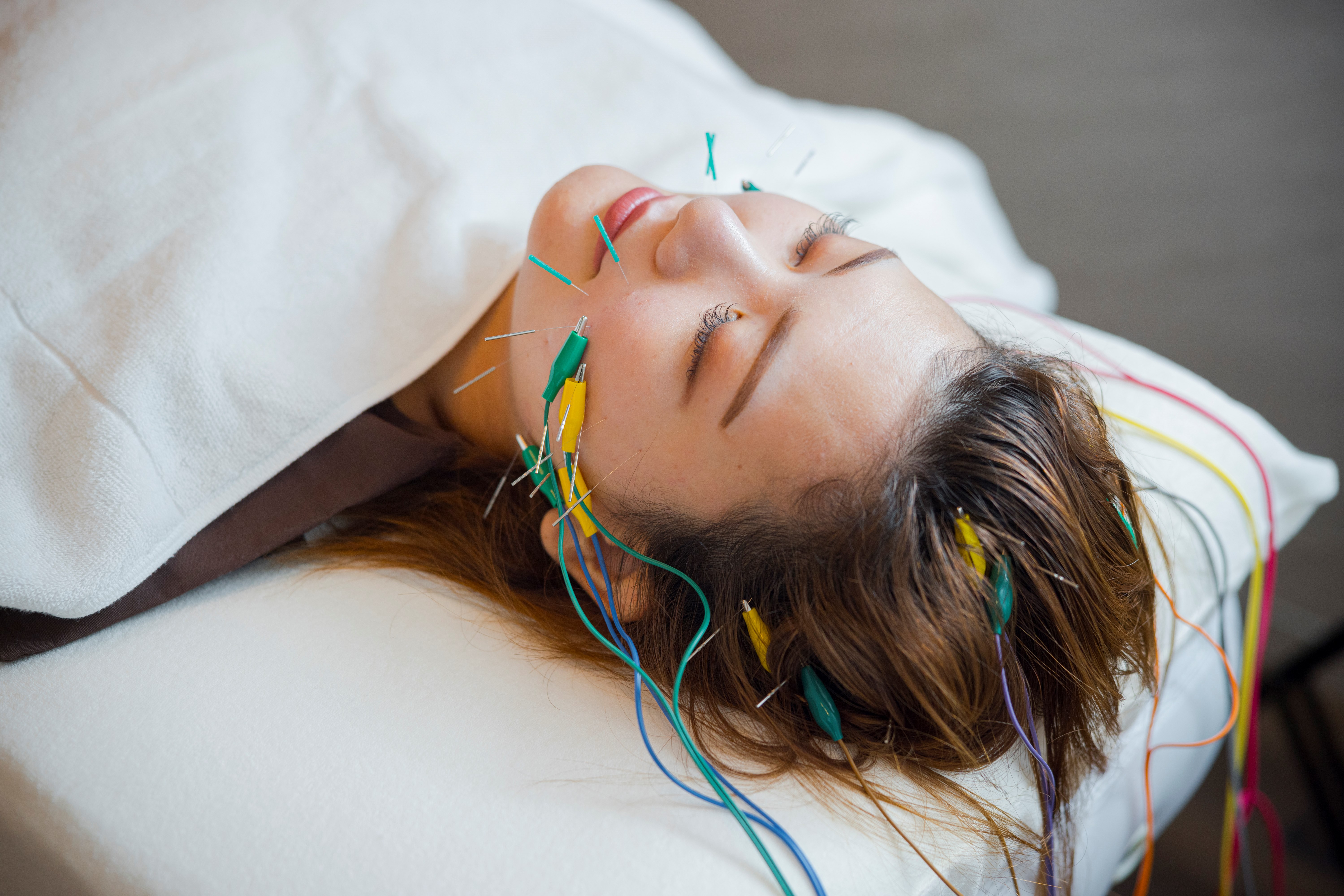 鍼灸治療/美容鍼δnp63+ 【初回】小顔美容鍼＋ヘッドマッサージ＋首肩こりほぐしのメニュー画像