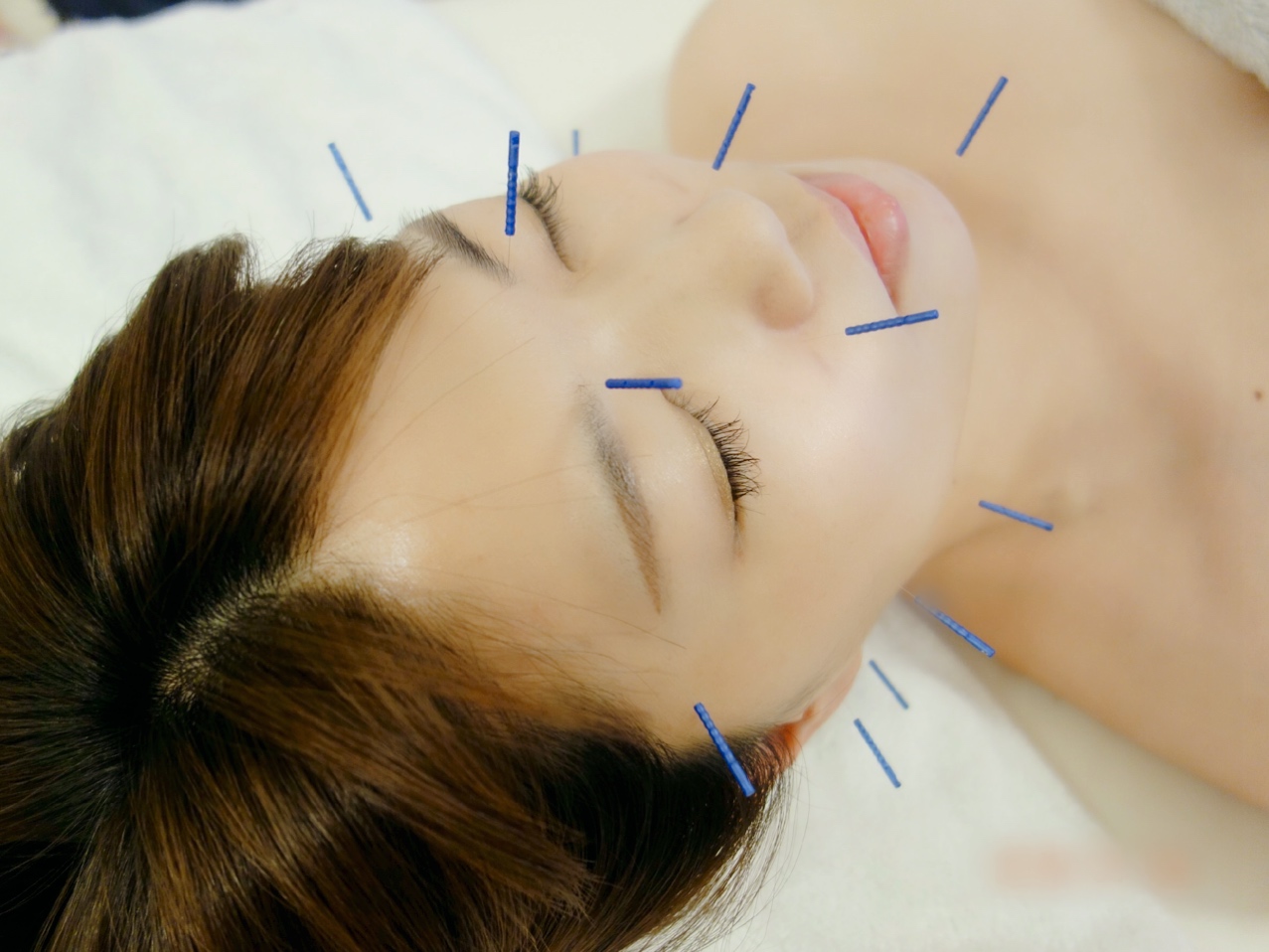 鍼灸サロン ハリシア 美容鍼とＳＭＡＳ（筋膜）施術のメニュー画像