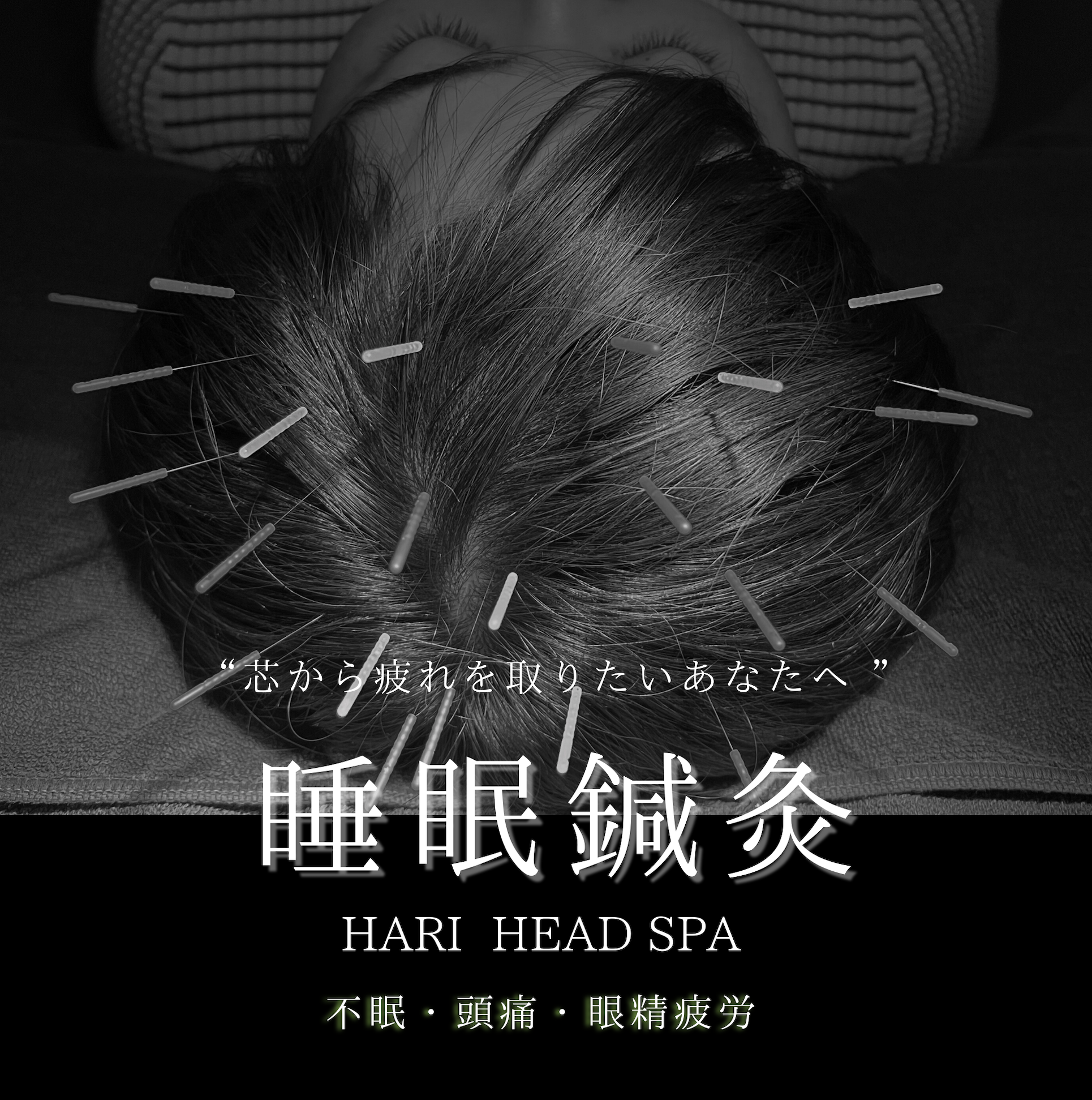 鍼灸サロン ハリッシュ 人気メニュー（2回目以降）睡眠・頭の凝り鍼灸　6600円　のメニュー画像