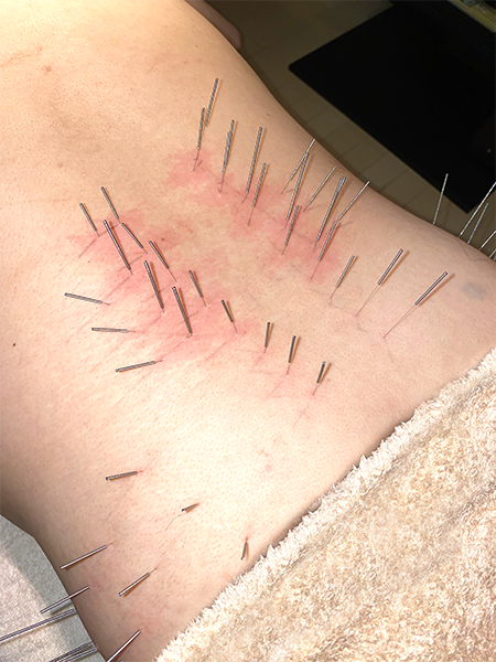 BON鍼灸 北京堂 千葉院 腰痛のメニュー画像