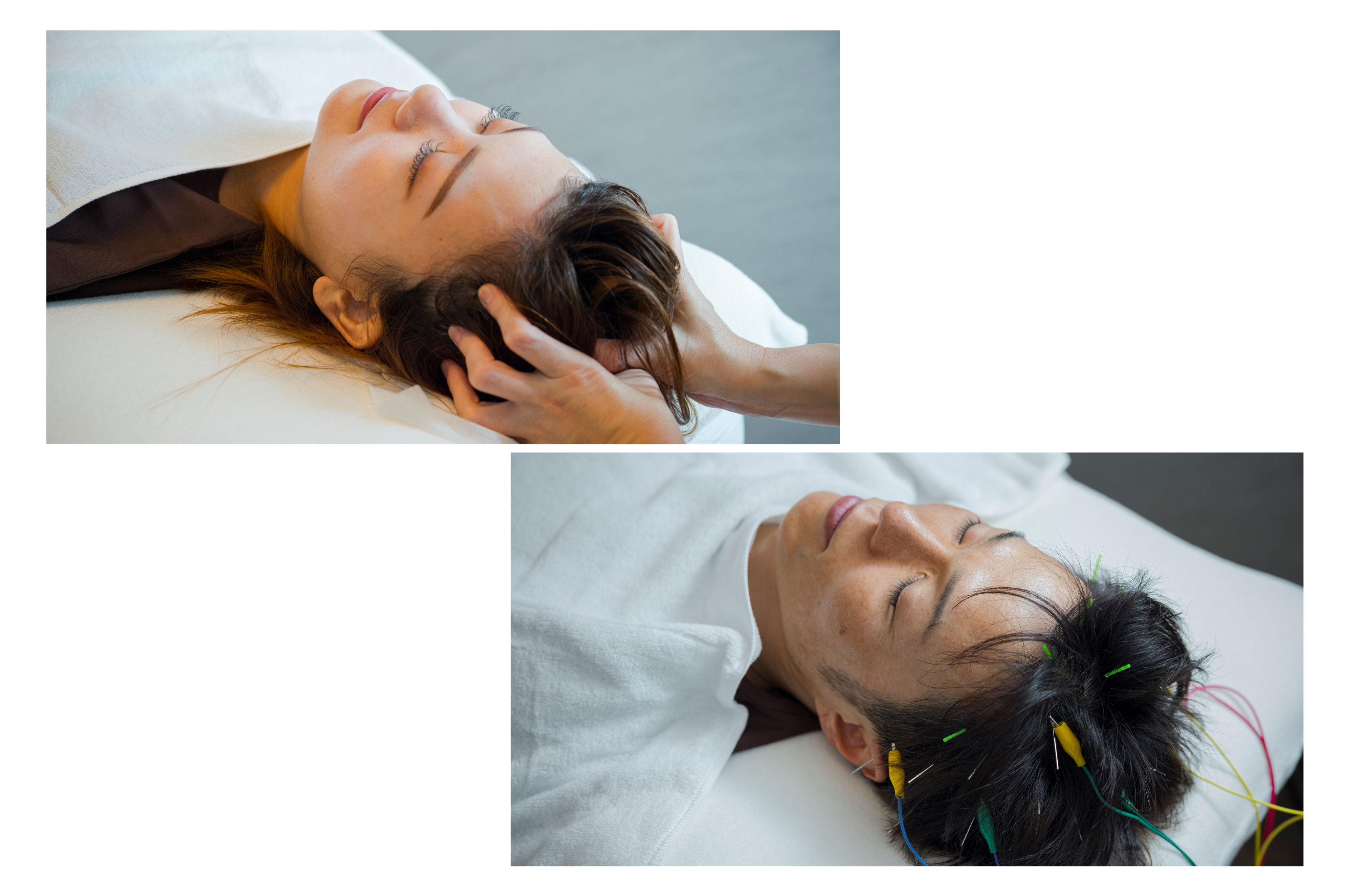 鍼灸治療/美容鍼δnp63+ 【初回おやすみコース】CBD炭酸ドライヘッドスパ+頭皮電気鍼+首肩こりのメニュー画像