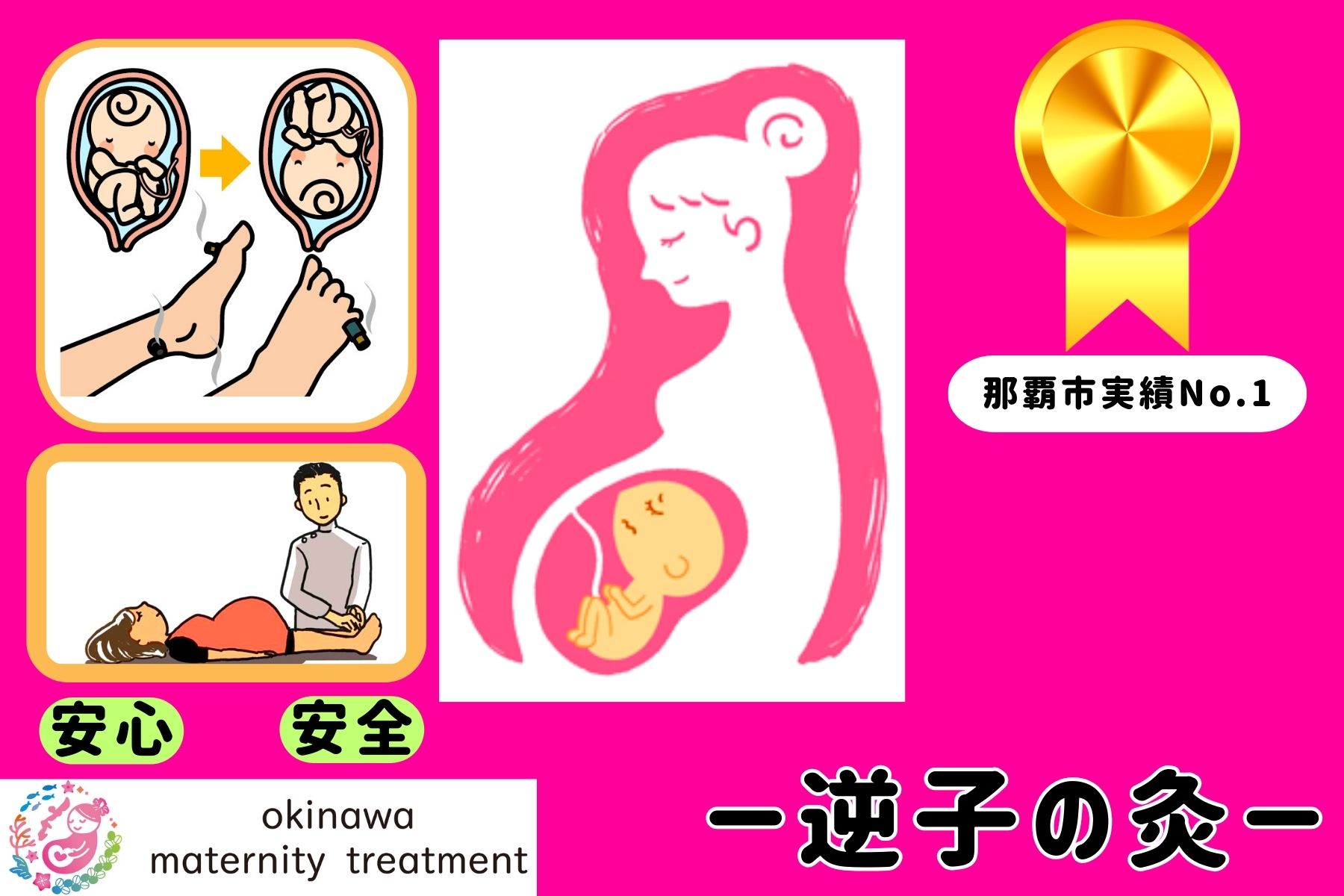 沖縄県那覇市首里スマイル鍼灸整骨院　本院 安心・安全【施術数実績豊富】逆子治療（鍼灸治療）暖かいお灸を使います。産婦人科、助産師さんからの紹介も多数あります。【産婦人科系予約】のメニュー画像