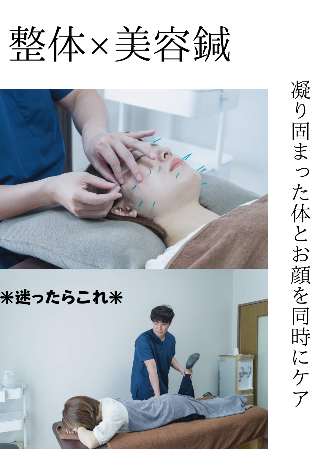 鍼灸整体サロンねこのひげ 【顔も体も整えたい！】整体×美容鍼で効果長続き！のメニュー画像