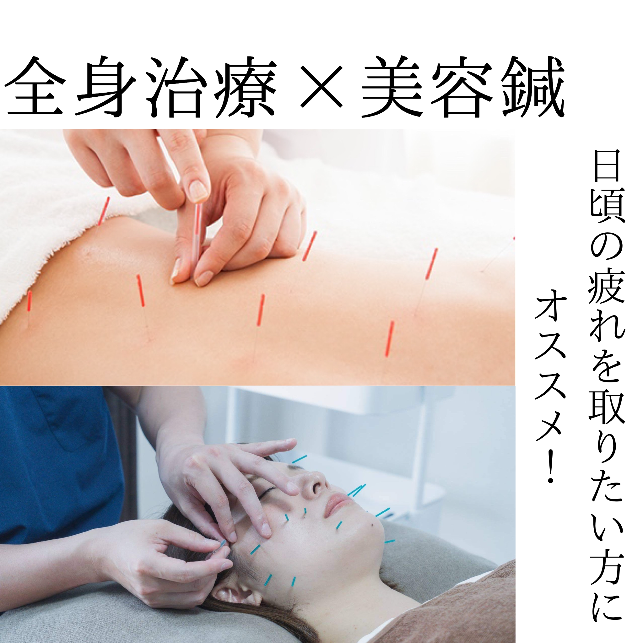 鍼灸整体サロンねこのひげ 【体の内側から綺麗になれる！】美容鍼灸コースのメニュー画像