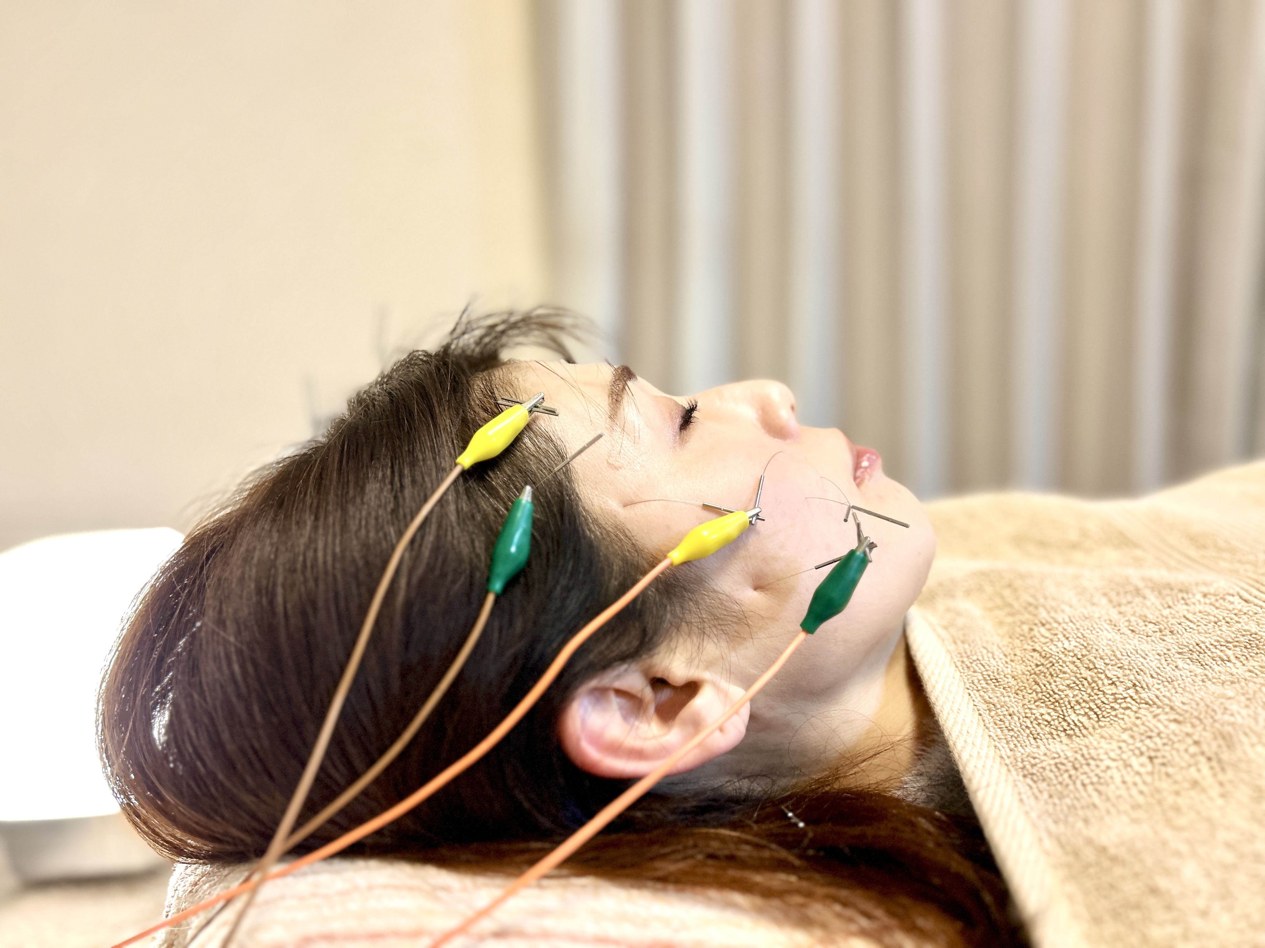 けいあい鍼灸治療院 2回目以降　肌育できる美容鍼コースのメニュー画像