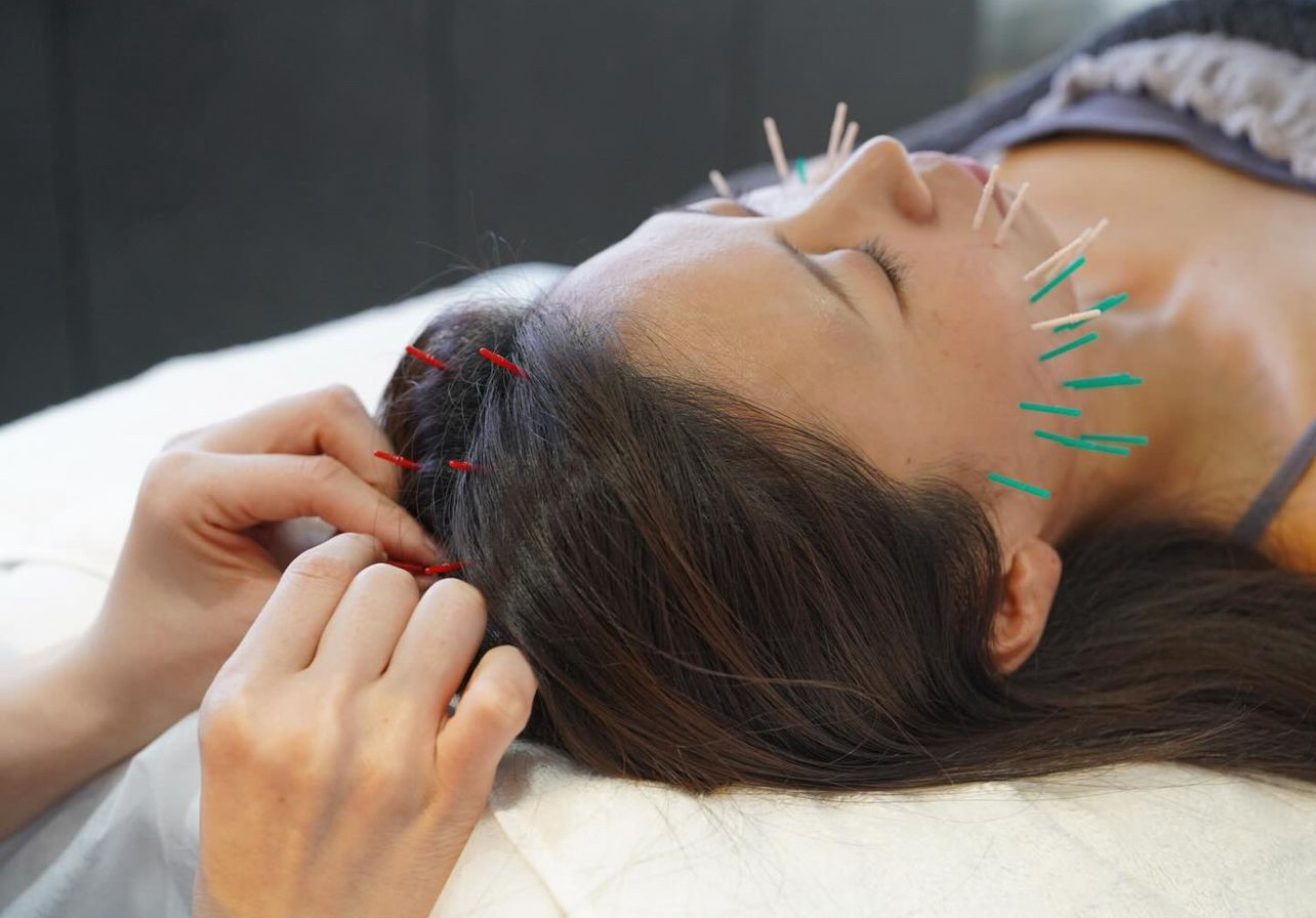 美容鍼灸サロンLumiere 肌管理美容鍼のメニュー画像