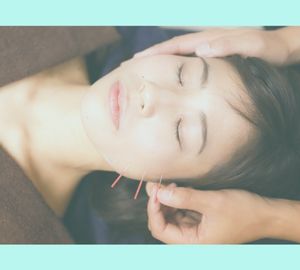 はり灸らぼ【女性限定】 【美鍼小顔60分】　美顔鍼＋首肩・眼精疲労の自律神経ととのう整顔のメニュー画像