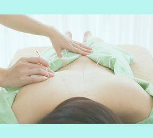 はり灸らぼ【女性限定】 *2回目以降はコチラ!【レギュラー70分】 自律神経ベースの鍼灸+整体/脱アレルギー諸症状のメニュー画像