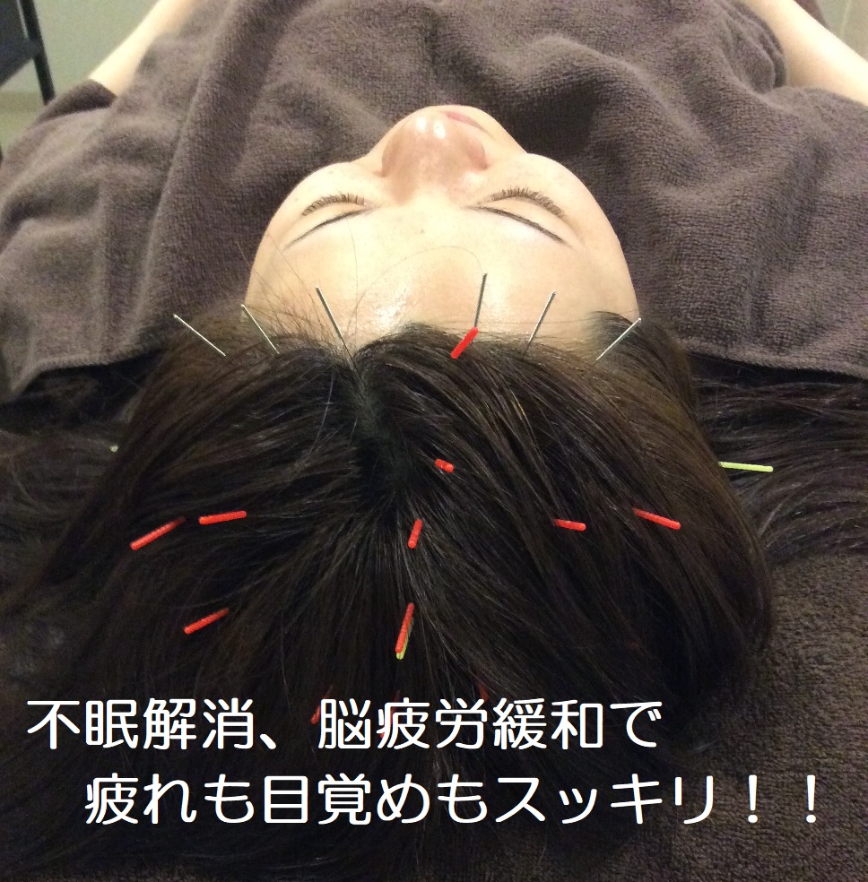 Well-beプラーカ鍼灸室 ～脳疲労改善、不眠解消～頭皮鍼灸のメニュー画像