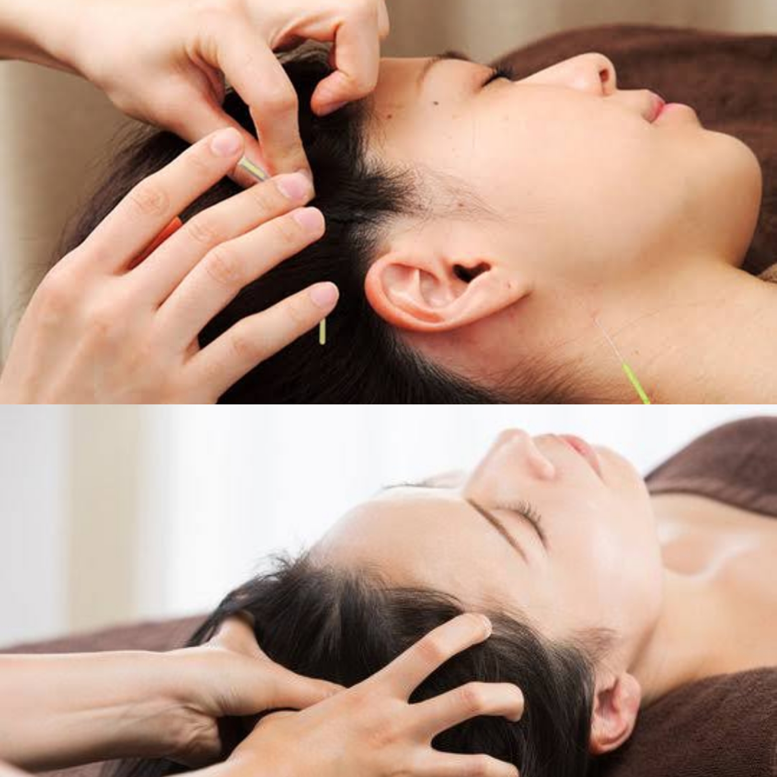 鍼灸 THALASSA 鍼灸ヘッドスパ(鍼刺激で頭皮の血流改善で頭痛や眼精疲労、抜け毛など髪の毛の悩みを改善)のメニュー画像