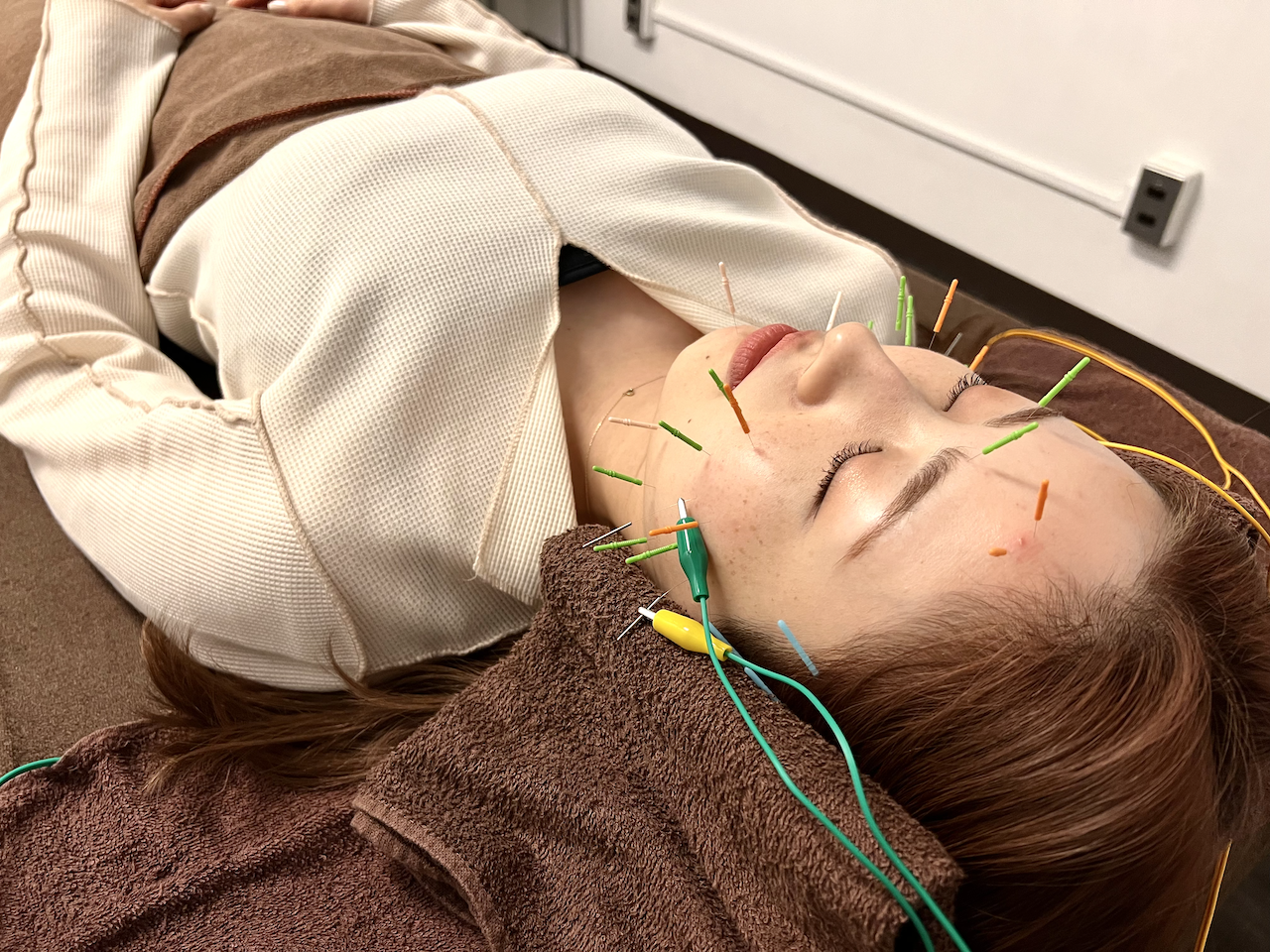 Belledio美容鍼灸整骨院 【おすすめNo,2】電気美容鍼+首肩リンパマッサージのメニュー画像