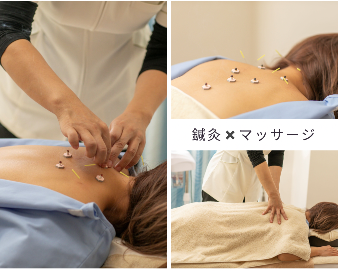 UTUKUSHI 【首肩コリ・腰痛　慢性疲労】慢性的なコリをケア　鍼灸＋マッサージのメニュー画像