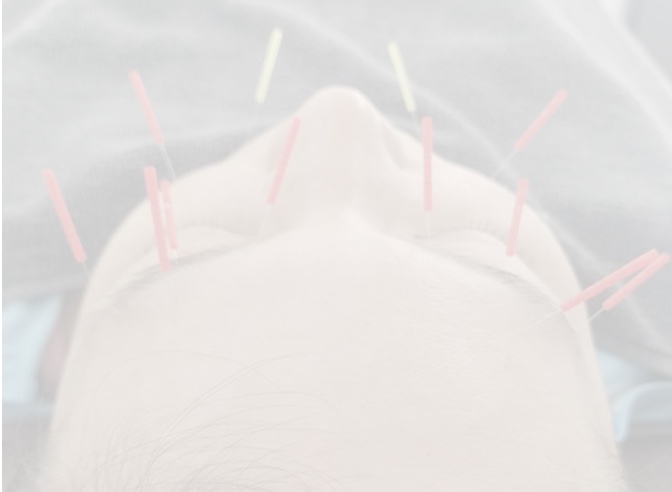 リラクゼーション鍼灸 HARIOKA 【２回目以降】美容鍼のメニュー画像