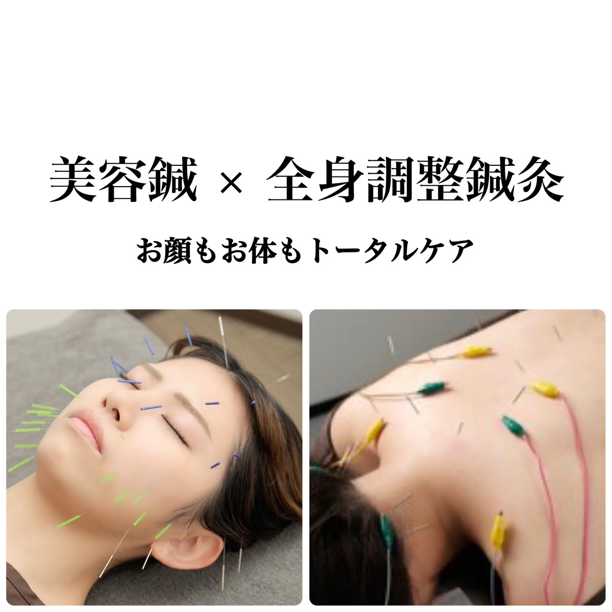 hari salon de off 南森町店 初回限定【圧倒的な効果を実感贅沢フルコース】美容鍼/美容鍼灸/全身調整鍼灸(90分)のメニュー画像