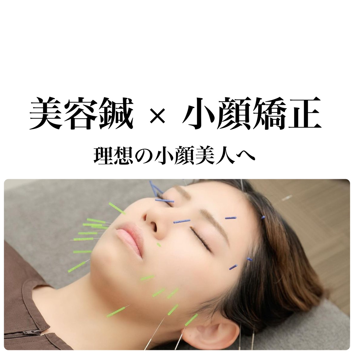 hari salon de off 南森町店 初回限定【極上小顔ケア】リッチリフトアップ美容鍼/美容鍼灸(60分)のメニュー画像