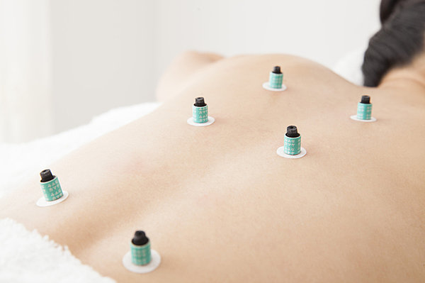 なのはなクリニック 鍼灸部門 基本治療(Basic Acupuncture and Moxibustion)のメニュー画像
