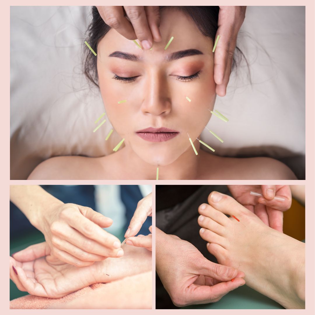 鍼灸Salon KUKUNA 小平店 美顔・美容鍼灸コース  30~40分のメニュー画像