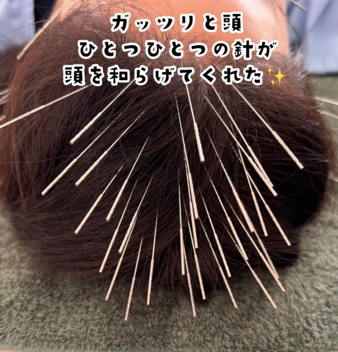 鍼処卓-taku- ｜ルート治療専門院｜次元上昇｜運気｜美容鍼｜北摂 ルート鍼治療　初診・再来診コースのメニュー画像