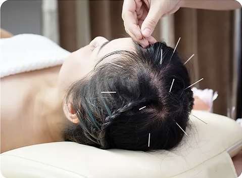 Panda鍼灸整体院(パンダ鍼灸整体院） 【自律神経調整】鍼のヘッドスパのメニュー画像