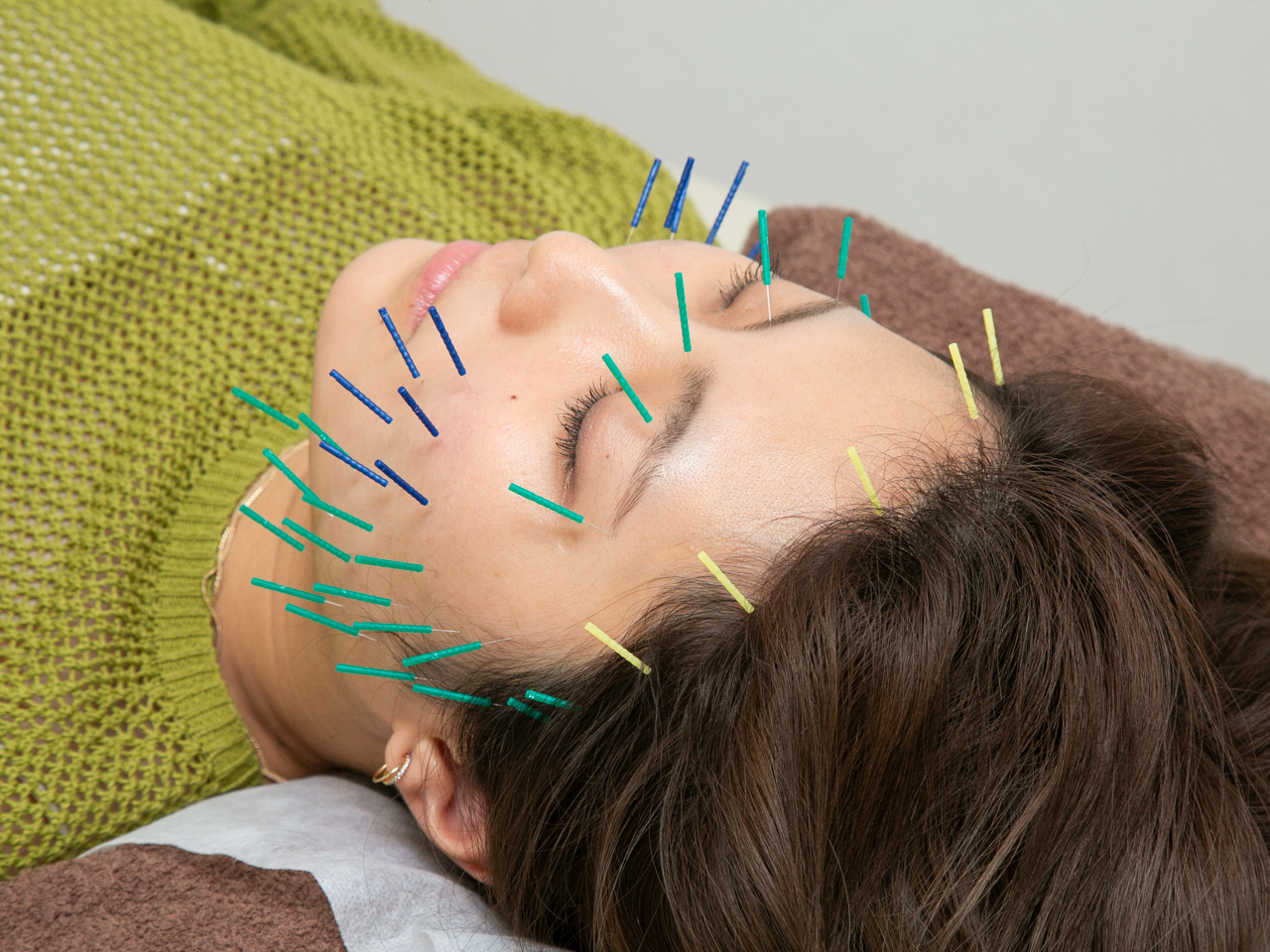 LUX美容鍼灸整体 プレミアム美容鍼　ご新規様価格 60分通常￥11000→5280のメニュー画像