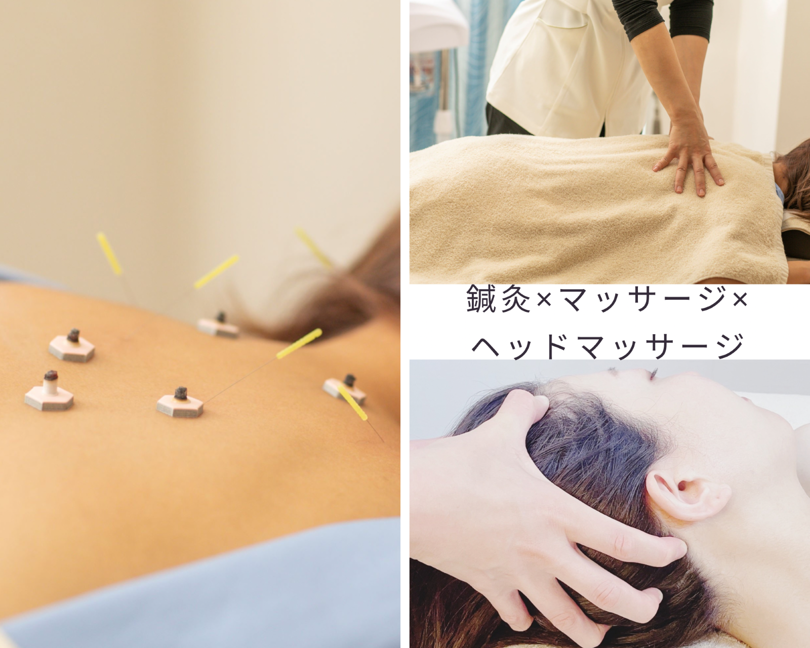 UTUKUSHI 【首肩コリ・腰痛・慢性疲労】慢性的なコリをケア　鍼灸30分＋マッサージ60分+ヘッドマッサージ20分のメニュー画像